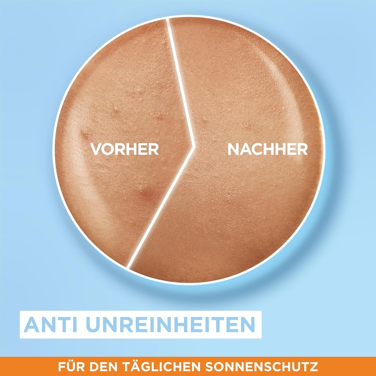 Garnier Ambre Solaire Sensitive Expert + Hydrating UV Water Sonnenschutzspray LSF 50 – Sonnen-Spray für Körper, Gesicht, Kopfhaut & Haare – Wasserfest, sandresistent & nicht fettend – 150ml